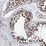 hnRNP M Antibody in Immunohistochemistry (Paraffin) (IHC (P))