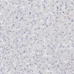 BICD2 Antibody in Immunohistochemistry (Paraffin) (IHC (P))