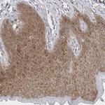 BICD2 Antibody in Immunohistochemistry (Paraffin) (IHC (P))