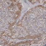 BICD2 Antibody in Immunohistochemistry (Paraffin) (IHC (P))