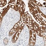 Cytokeratin 20 Antibody in Immunohistochemistry (Paraffin) (IHC (P))