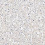 Cytokeratin 20 Antibody in Immunohistochemistry (Paraffin) (IHC (P))