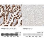 Cytokeratin 20 Antibody