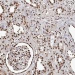 PIMT Antibody in Immunohistochemistry (Paraffin) (IHC (P))