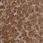 BLZF1 Antibody in Immunohistochemistry (Paraffin) (IHC (P))