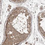 BLZF1 Antibody in Immunohistochemistry (Paraffin) (IHC (P))