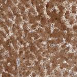 ACAT2 Antibody in Immunohistochemistry (Paraffin) (IHC (P))