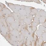 ACAT2 Antibody in Immunohistochemistry (Paraffin) (IHC (P))