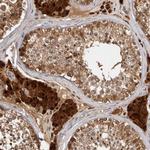 ACAT2 Antibody in Immunohistochemistry (Paraffin) (IHC (P))