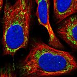 Fumarase Antibody in Immunocytochemistry (ICC/IF)