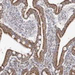 Fumarase Antibody in Immunohistochemistry (Paraffin) (IHC (P))