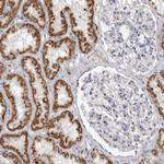 Fumarase Antibody in Immunohistochemistry (Paraffin) (IHC (P))