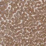 Fumarase Antibody in Immunohistochemistry (Paraffin) (IHC (P))