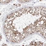 Fumarase Antibody in Immunohistochemistry (Paraffin) (IHC (P))