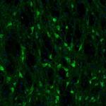 Fumarase Antibody in Immunohistochemistry (Paraffin) (IHC (P))