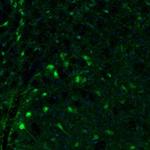 Fumarase Antibody in Immunohistochemistry (Paraffin) (IHC (P))