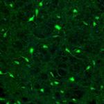 Fumarase Antibody in Immunohistochemistry (Paraffin) (IHC (P))