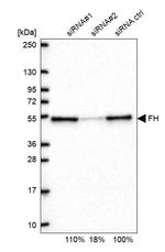 Fumarase Antibody