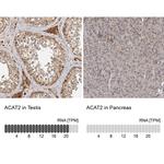 ACAT2 Antibody