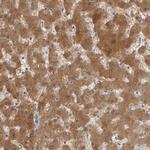 ACAT2 Antibody in Immunohistochemistry (Paraffin) (IHC (P))