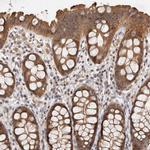 ACAT2 Antibody in Immunohistochemistry (Paraffin) (IHC (P))