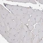 ACAT2 Antibody in Immunohistochemistry (Paraffin) (IHC (P))