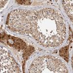 ACAT2 Antibody in Immunohistochemistry (Paraffin) (IHC (P))