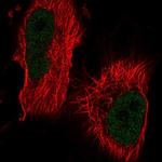 ThPOK Antibody in Immunocytochemistry (ICC/IF)