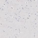 ThPOK Antibody in Immunohistochemistry (Paraffin) (IHC (P))