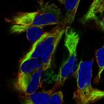 Nestin Antibody in Immunocytochemistry (ICC/IF)