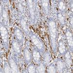 Nestin Antibody in Immunohistochemistry (Paraffin) (IHC (P))