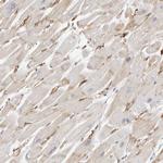 Nestin Antibody in Immunohistochemistry (Paraffin) (IHC (P))