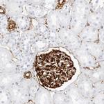 Nestin Antibody in Immunohistochemistry (Paraffin) (IHC (P))