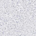 Nestin Antibody in Immunohistochemistry (Paraffin) (IHC (P))