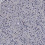 CaMKII delta Antibody in Immunohistochemistry (Paraffin) (IHC (P))