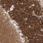 CaMKII beta Antibody in Immunohistochemistry (Paraffin) (IHC (P))