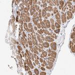 CaMKII beta Antibody in Immunohistochemistry (Paraffin) (IHC (P))