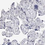 CaMKII beta Antibody in Immunohistochemistry (Paraffin) (IHC (P))