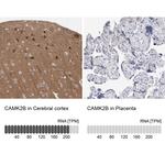 CaMKII beta Antibody