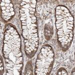 HDAC6 Antibody in Immunohistochemistry (Paraffin) (IHC (P))