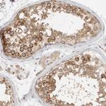 HDAC6 Antibody in Immunohistochemistry (Paraffin) (IHC (P))