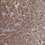 AKR1B1 Antibody in Immunohistochemistry (Paraffin) (IHC (P))