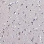 AKR1B1 Antibody in Immunohistochemistry (Paraffin) (IHC (P))