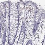 AKR1B1 Antibody in Immunohistochemistry (Paraffin) (IHC (P))