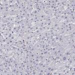 AKR1B1 Antibody in Immunohistochemistry (Paraffin) (IHC (P))