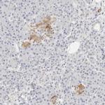 VLK Antibody in Immunohistochemistry (Paraffin) (IHC (P))