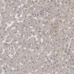 MST3 Antibody in Immunohistochemistry (Paraffin) (IHC (P))