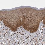 MST3 Antibody in Immunohistochemistry (Paraffin) (IHC (P))