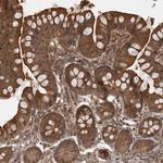 MST3 Antibody in Immunohistochemistry (Paraffin) (IHC (P))