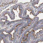 CD59 Antibody in Immunohistochemistry (Paraffin) (IHC (P))